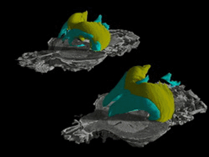 Image: Two mouse brains are compared to determine physical changes caused by genetic modifications (photo courtesy Duke University). Image: Two mouse brains are compared to determine physical changes caused by genetic modifications (photo courtesy Duke University).